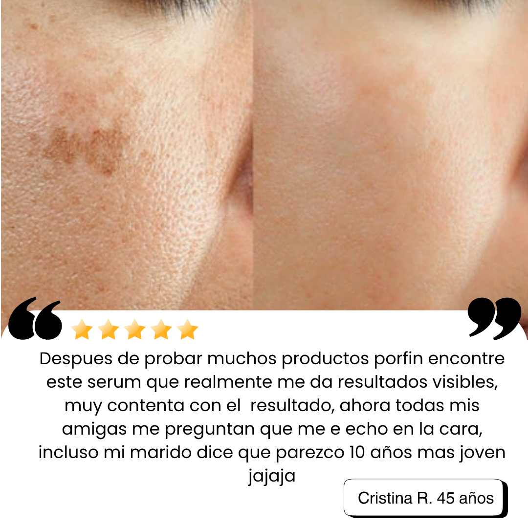 Sérum Facial Rejuvenecedor - Vitamina C + Escualano