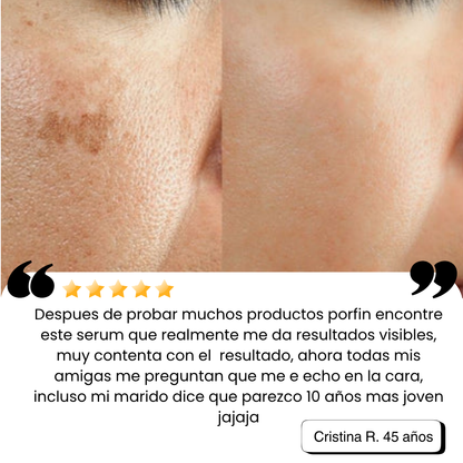 Sérum Facial Rejuvenecedor - Vitamina C + Escualano