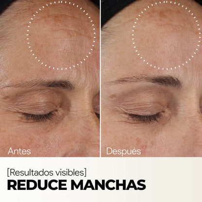 Sérum Facial Rejuvenecedor - Vitamina C + Escualano