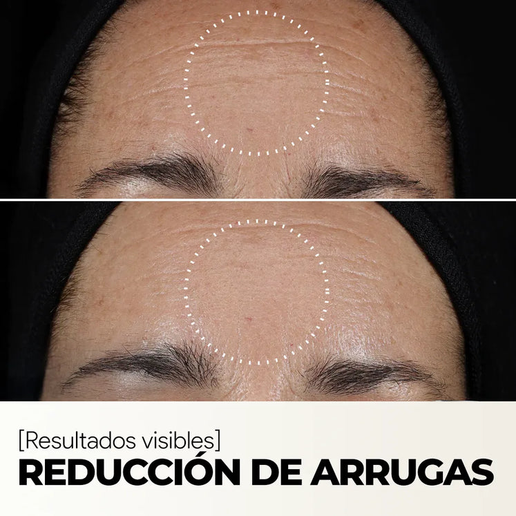 Sérum Facial Rejuvenecedor - Vitamina C + Escualano
