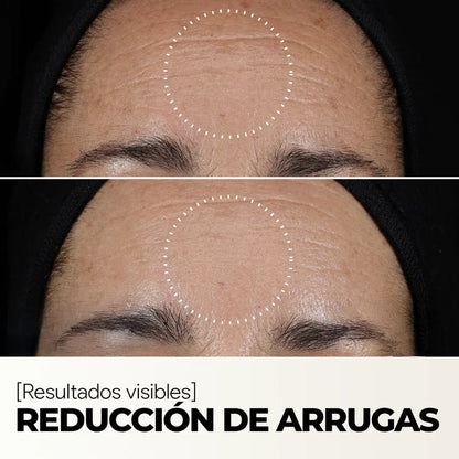 Sérum Facial Rejuvenecedor - Vitamina C + Escualano