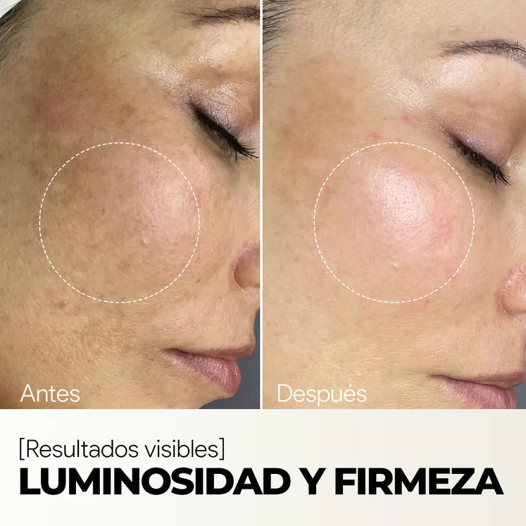 Sérum Facial Rejuvenecedor - Vitamina C + Escualano