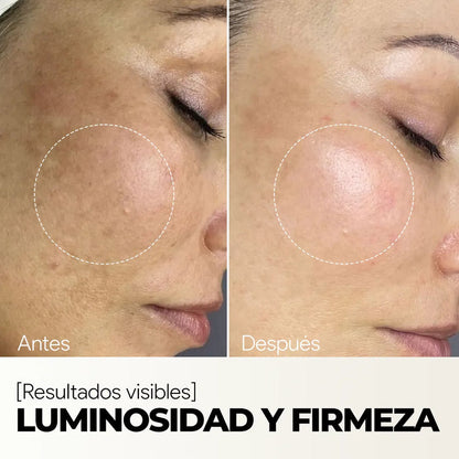 Sérum Facial Rejuvenecedor - Vitamina C + Escualano