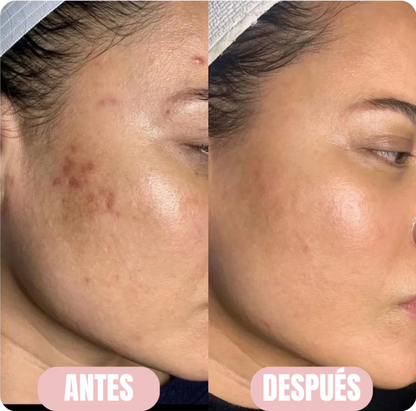 Mascarilla de colágeno - Hidratación profunda - Orvian