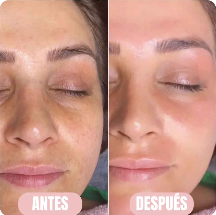 Mascarilla de colágeno - Hidratación profunda - Orvian